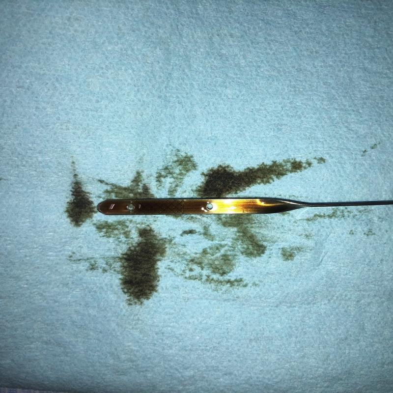 オイルレベルを確認してエンジンオイル交換は終了です。
オイル管理が悪いとエンジン内部に酸化物質が溜まりトラブルが表面化しますが、SOD-1Plusを添加すれば未然に防ぎます。
